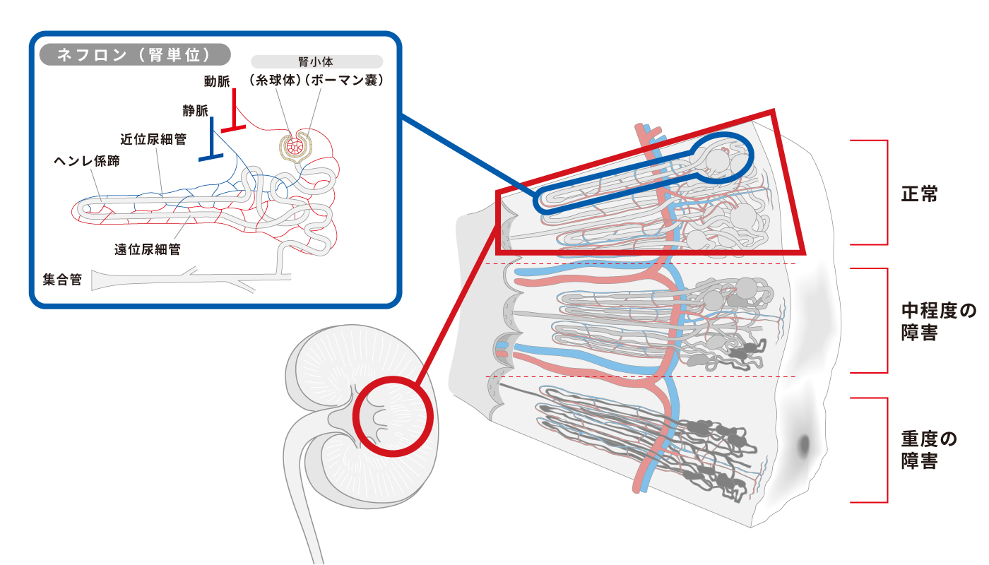 腎臓の像の構造（拡大図）